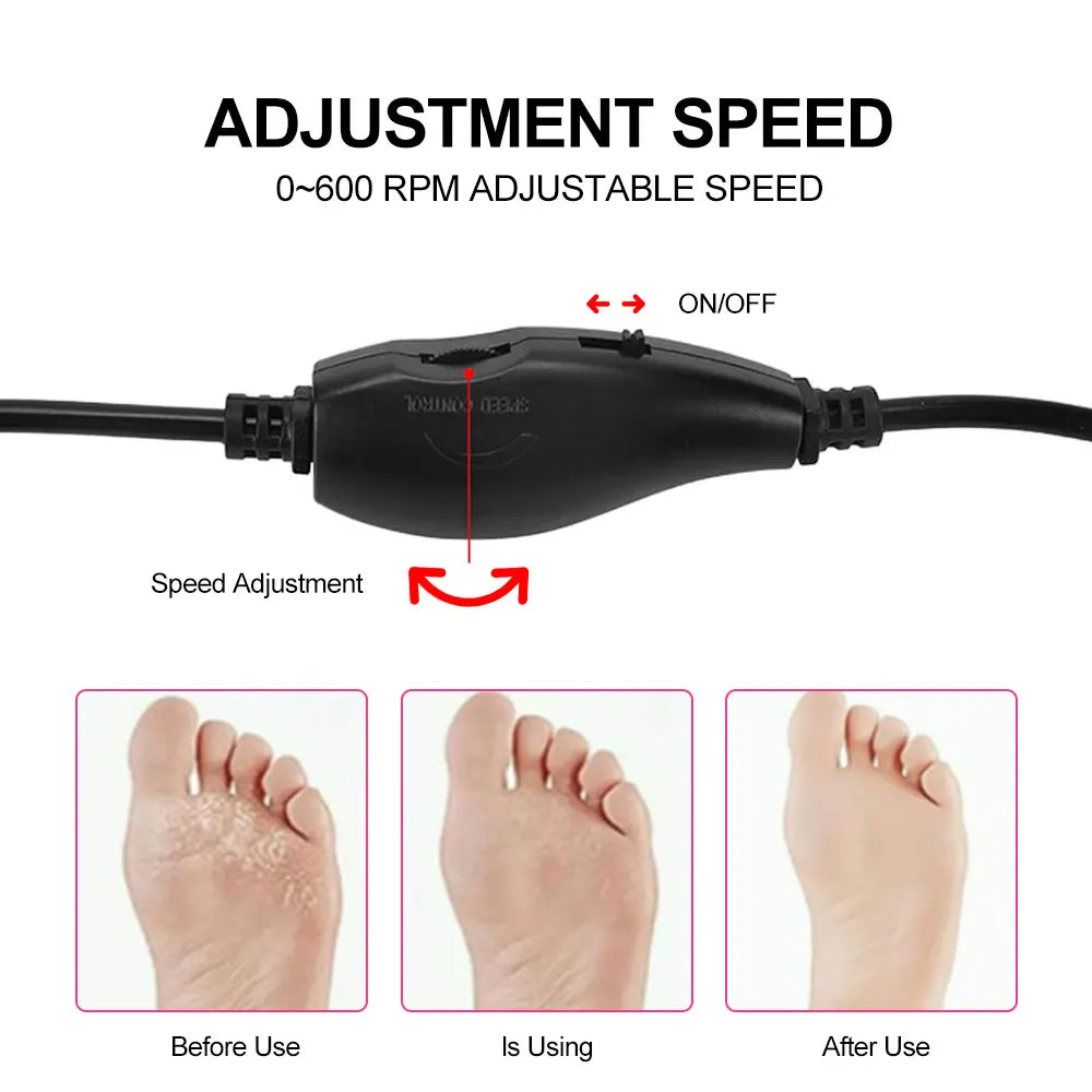 Electric Foot Callus Remover