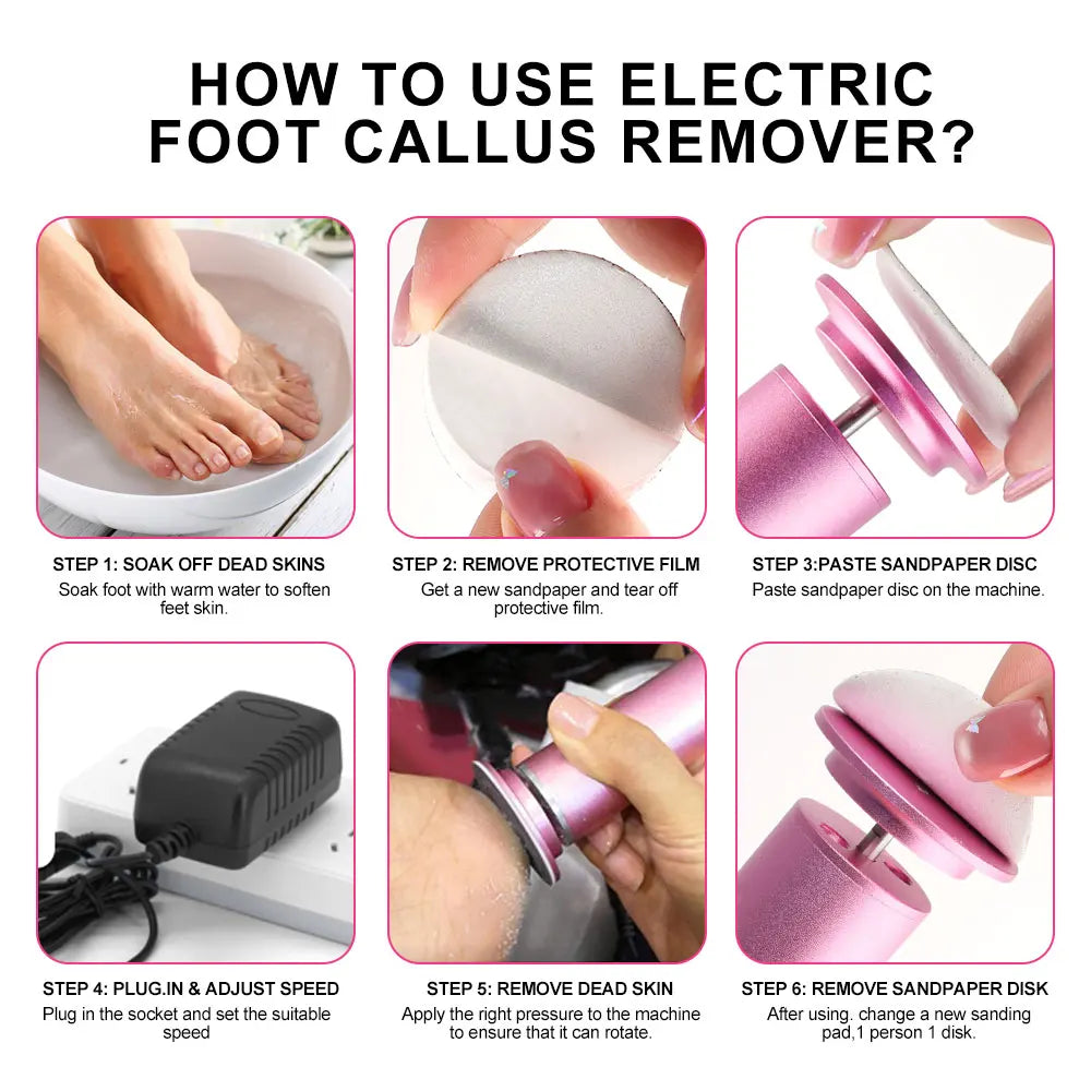 Electric Foot Callus Remover